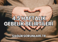 4.5 Haftalık Gebelik Belirtileri