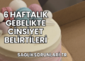6 Haftalık Gebelikte Cinsiyet Belirtileri