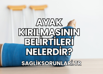 Ayak Kırılmasının Belirtileri Nelerdir?