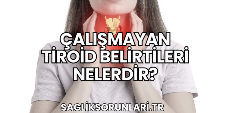 Çalışmayan Tiroid Belirtileri Nelerdir?