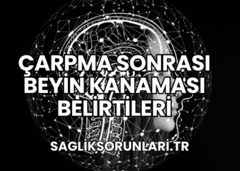 Çarpma Sonrası Beyin Kanaması Belirtileri