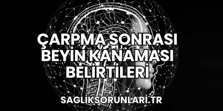 Çarpma Sonrası Beyin Kanaması Belirtileri