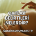 Çatlak Belirtileri Nelerdir?