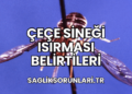 Çeçe Sineği Isırması Belirtileri
