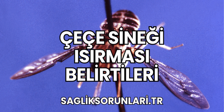 Çeçe Sineği Isırması Belirtileri