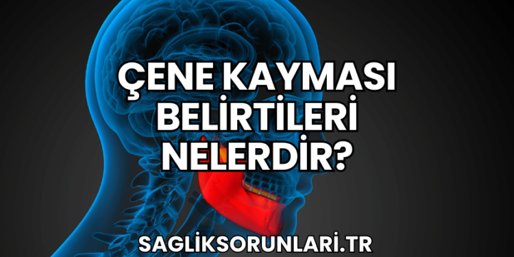 Çene Kayması Belirtileri Nelerdir?