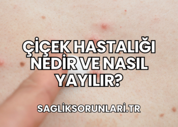 Çiçek Hastalığı Nedir ve Nasıl Yayılır?