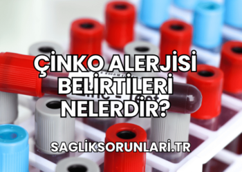 Çinko Alerjisi Belirtileri Nelerdir?