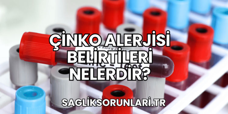 Çinko Alerjisi Belirtileri Nelerdir?