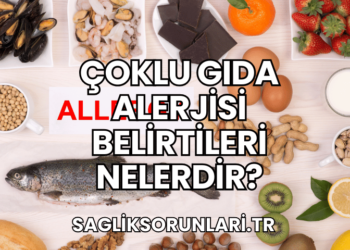 Çoklu Gıda Alerjisi Belirtileri Nelerdir?