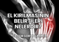 El Kırılmasının Belirtileri Nelerdir?
