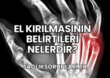 El Kırılmasının Belirtileri Nelerdir?