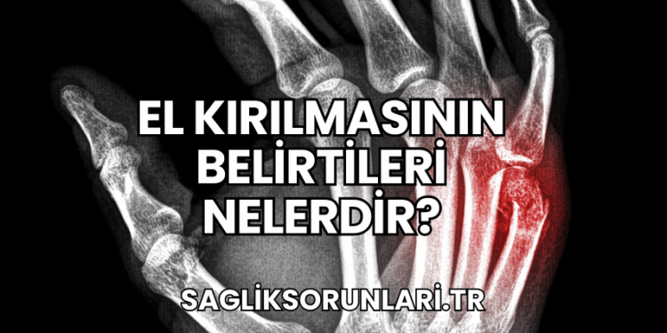 El Kırılmasının Belirtileri Nelerdir?