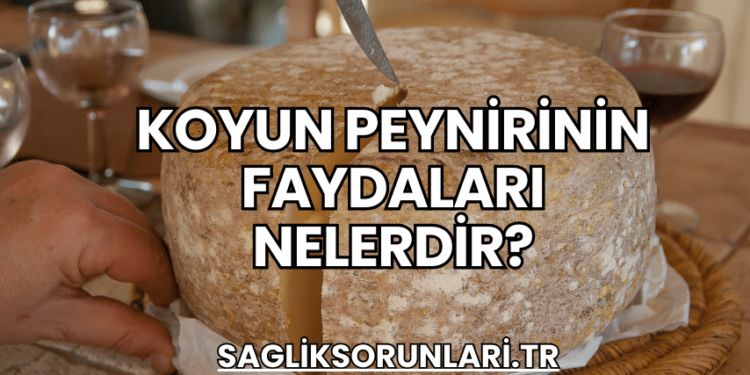 Koyun Peynirinin Faydaları Nelerdir?