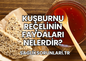 Kuşburnu Reçelinin Faydaları Nelerdir?