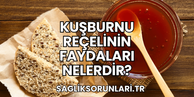 Kuşburnu Reçelinin Faydaları Nelerdir?