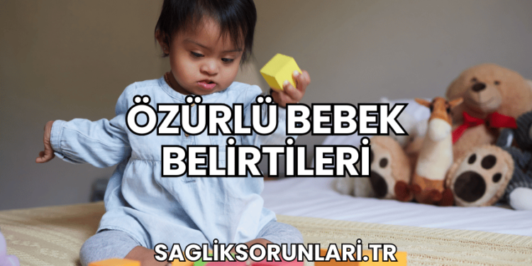 Özürlü Bebek Belirtileri
