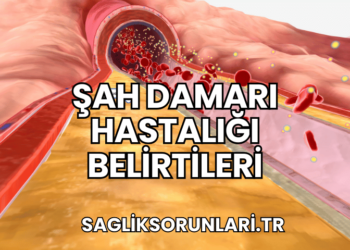Şah Damarı Hastalığı Belirtileri