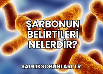 Şarbonun Belirtileri Nelerdir?