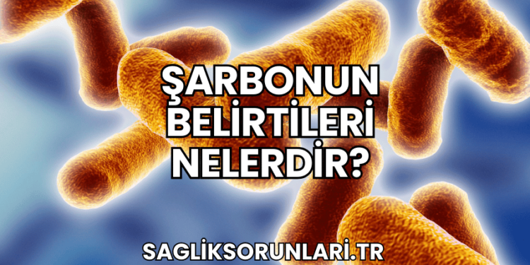 Şarbonun Belirtileri Nelerdir?