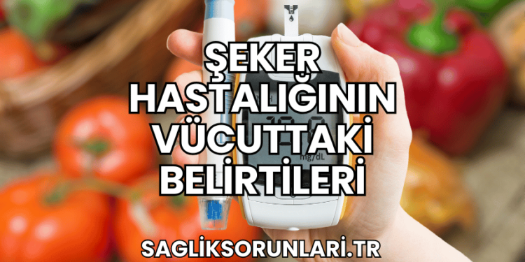 Şeker Hastalığının Vücuttaki Belirtileri