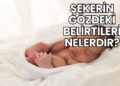 Şekerin Gözdeki Belirtileri Nelerdir?