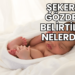 Şekerin Gözdeki Belirtileri Nelerdir?