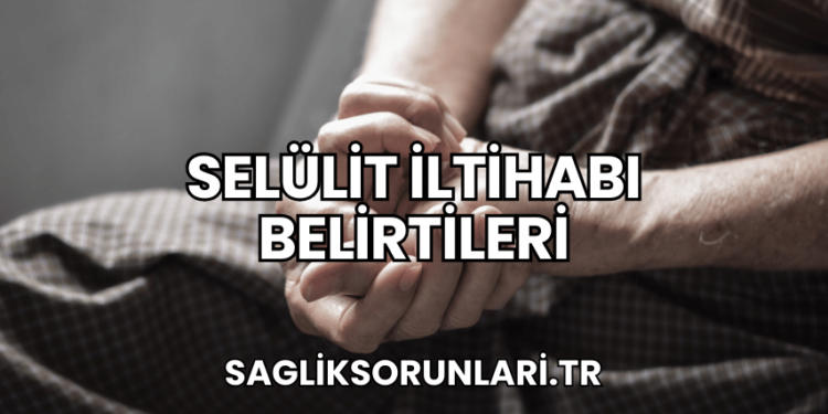 Selülit İltihabı Belirtileri