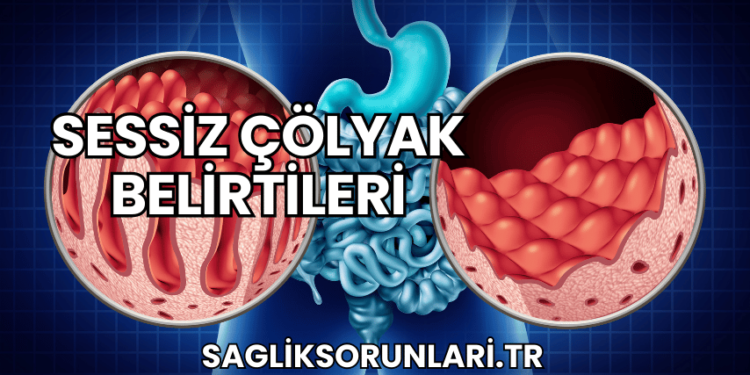 Sessiz Çölyak Belirtileri