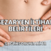 Sezaryen İltihap Belirtileri