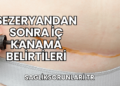 Sezeryandan Sonra İç Kanama Belirtileri