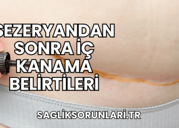 Sezeryandan Sonra İç Kanama Belirtileri