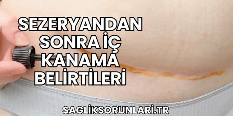 Sezeryandan Sonra İç Kanama Belirtileri