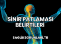 Sinir Patlaması Belirtileri
