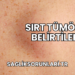 Sırt Tümörü Belirtileri