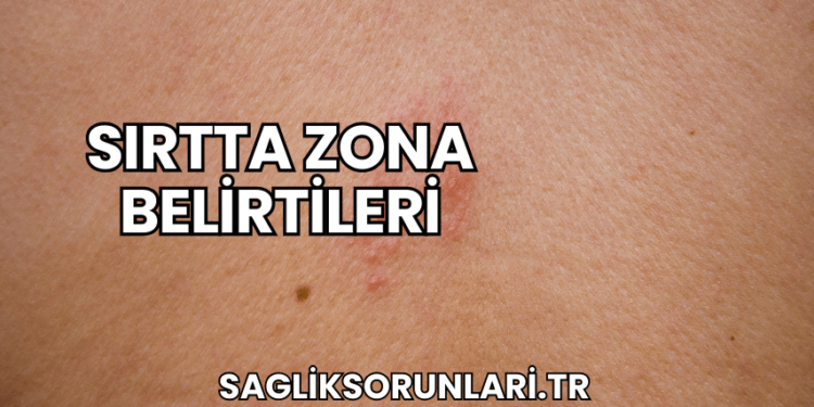 Sırtta Zona Belirtileri