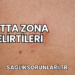 Sırtta Zona Belirtileri