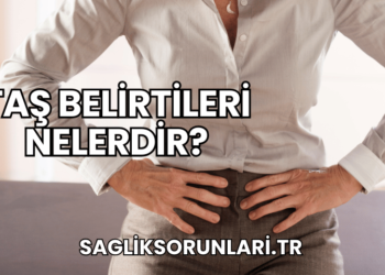 Taş Belirtileri Nelerdir?
