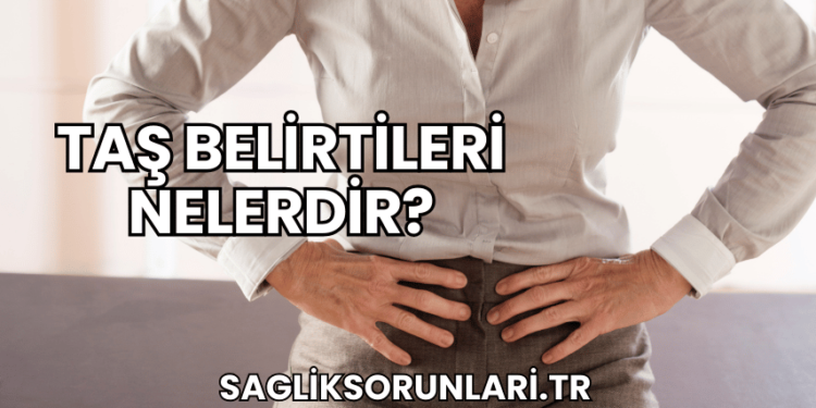 Taş Belirtileri Nelerdir?