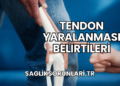 Tendon Yaralanması Belirtileri