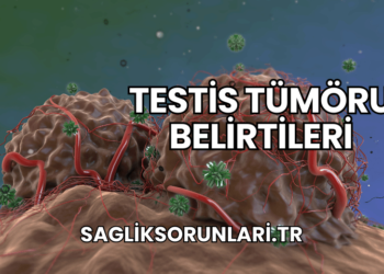 Testis Tümöru Belirtileri