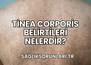 Tinea Corporis Belirtileri Nelerdir?