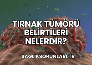 Tırnak Tümörü Belirtileri Nelerdir?