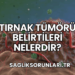 Tırnak Tümörü Belirtileri Nelerdir?