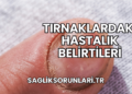 Tırnaklardaki Hastalık Belirtileri