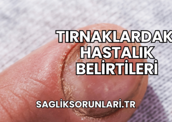 Tırnaklardaki Hastalık Belirtileri