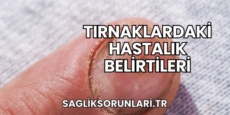 Tırnaklardaki Hastalık Belirtileri