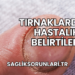 Tırnaklardaki Hastalık Belirtileri