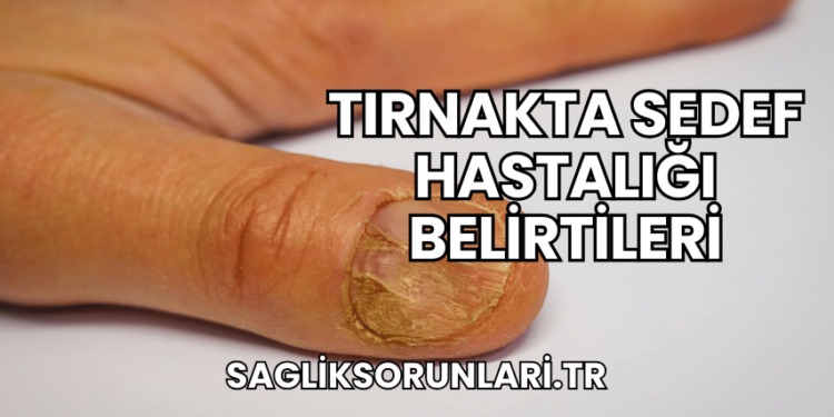 Tırnakta Sedef Hastalığı Belirtileri