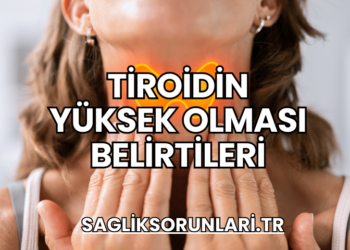 Tiroidin Yüksek Olması Belirtileri